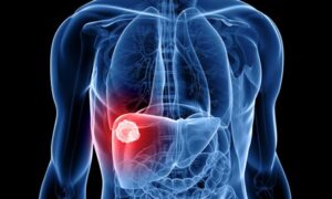 Liver Disease Treatment in Pune