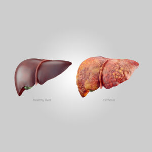 Liver disease treatment in Pune