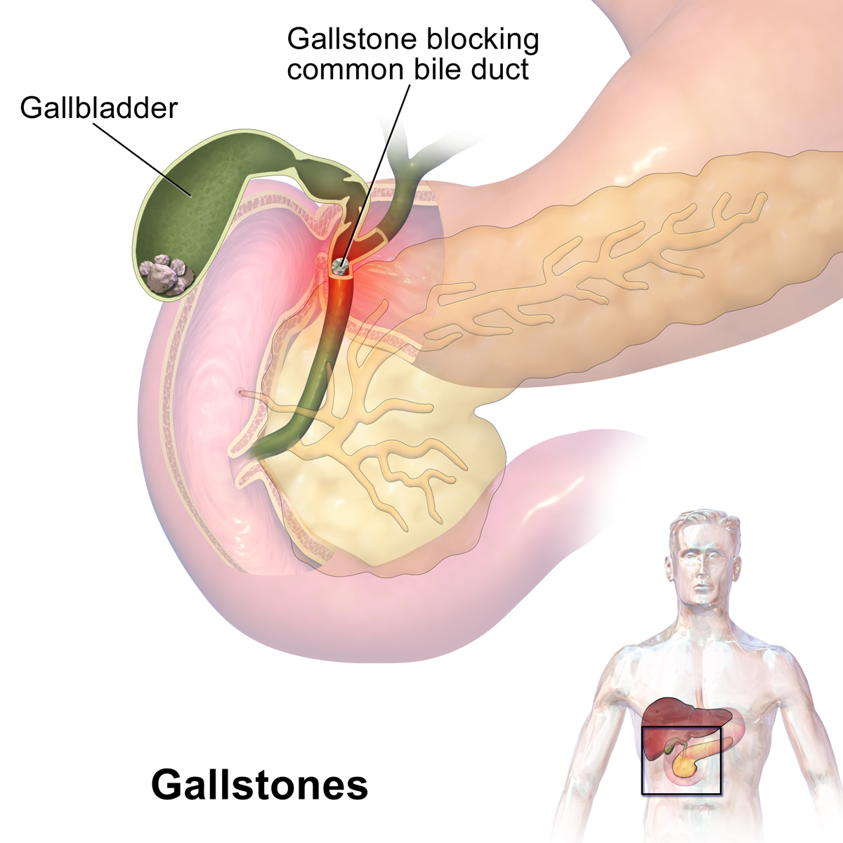 Liver transplant surgeon in Pune