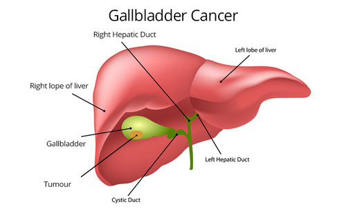 Liver transplant surgeon in Pune