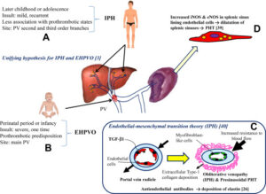 Liver disease treatment in Pune