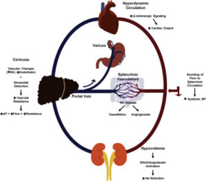 Liver disease treatment in Pune