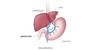 Liver disease treatment in Pune