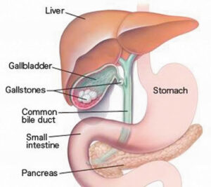 Liver transplant surgeon in Pune