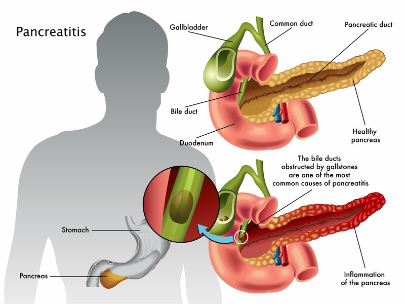 Liver transplant surgeon in Pune