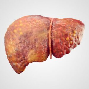 Liver disease treatment in Pune