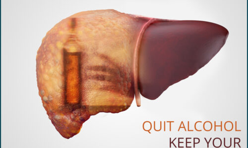 apollohospitals_healthcare_liverdisease apollohospitals_healthcare_liverdisease